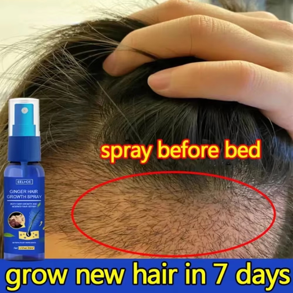 Hair Care For Hair Loss - 빠른 생강 모발 성장 스프레이, 모발