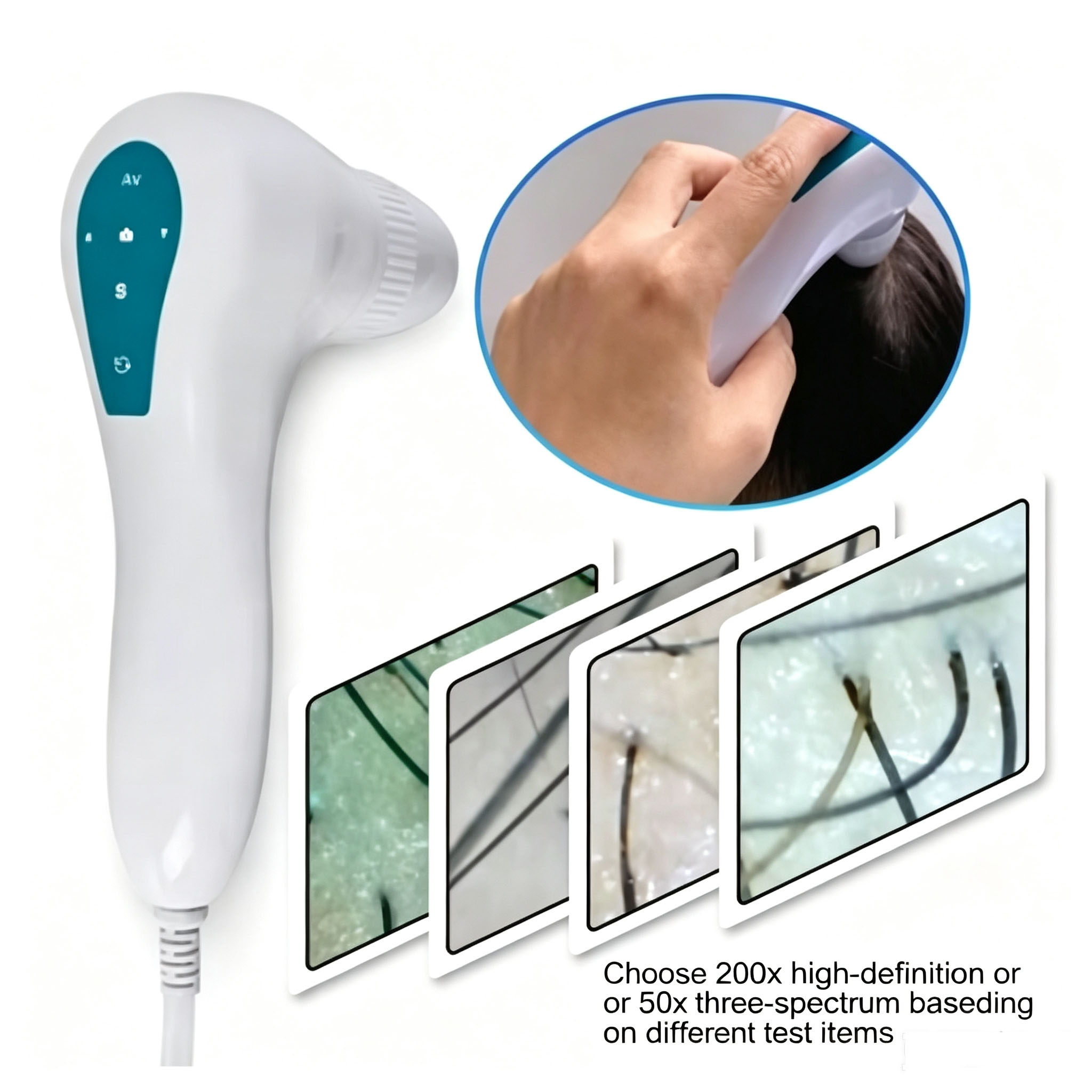 탈모 방지 두피 모낭 감지기, 헤어 살롱 전용 고화질  - Hair Care For Hair Loss 리뷰 및 가격
