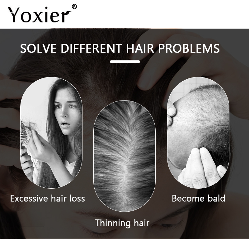 인텐시브 성장 세럼 탈모 방지 스프레이 두피 트리트먼트 - Hair Care For Hair Loss 리뷰 및 가격