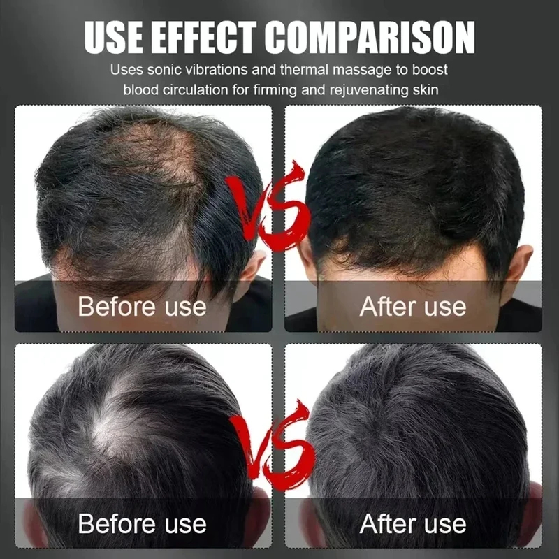 660nm 850nm 레드 라이트 적외선 헤어 테라피  - Hair Care For Hair Loss 리뷰 및 가격